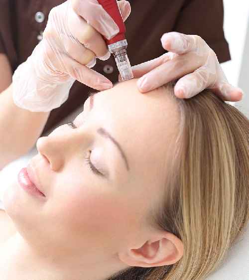 Mesotherapy